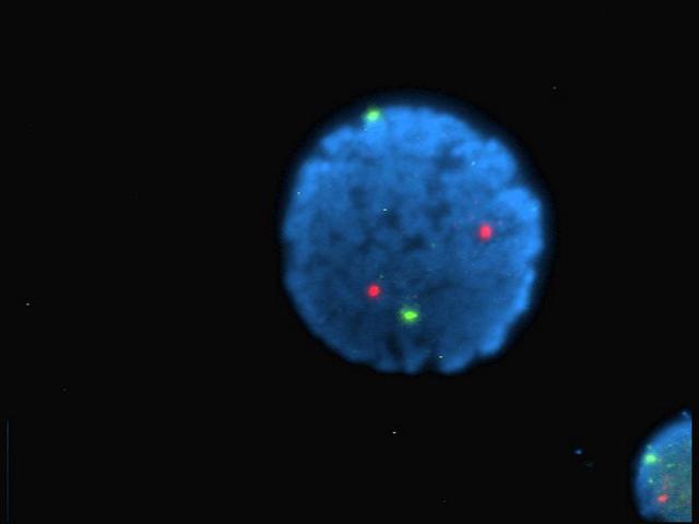 Human cell labelled with Fluorophores